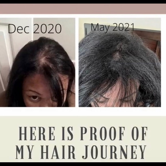 Multi-patented Liquid BioCell - Liquid Collagen https://modere.co/3CKXFAh - Picture 2 of 16